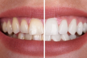 antalya dental clinic (1)