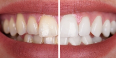 antalya dental clinic (1)
