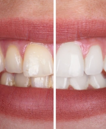 antalya dental clinic (1)