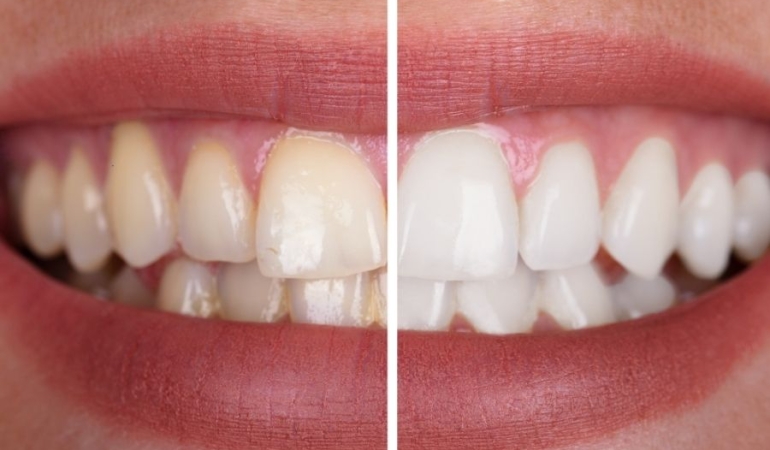 antalya dental clinic (1)