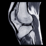 Ortopedik Sorunlar ve Tedavi Yöntemleri